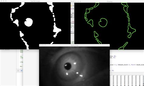 opencv - Eye tracking in Android - Stack Overflow