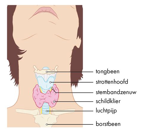 operatie bijschildklier