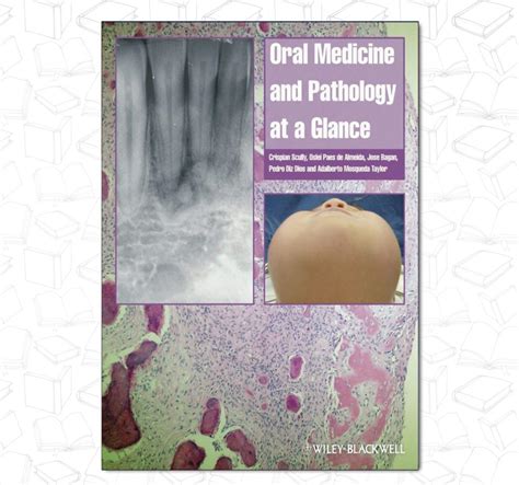 Full Download Oral Medicine And Pathology At A Glance 