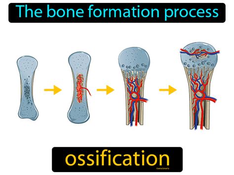 ossification meaning in Malayalam ossification translation in ...