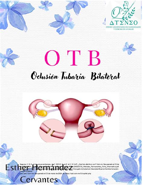Otb Que Es