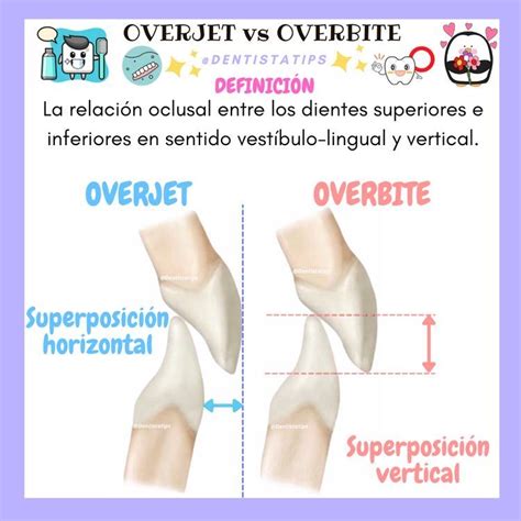 Overbite Y Overjet