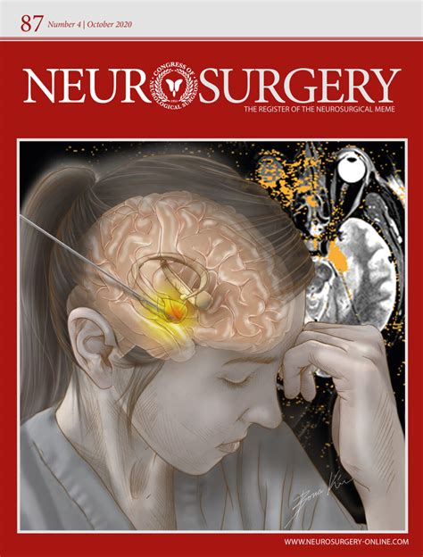 overshunting Archives - Neurosurgery