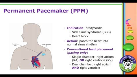 pacemaker tomcat status url er