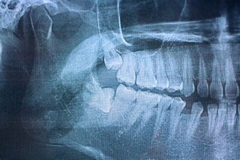 panoramic gigi | Eiffel Tower Restaurant Las Vegas nh gi