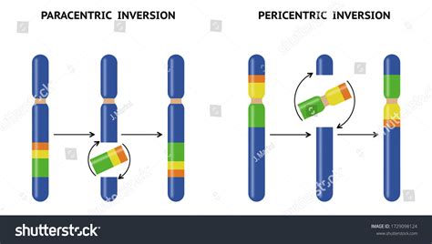 Paracentric Pericentric Inversion