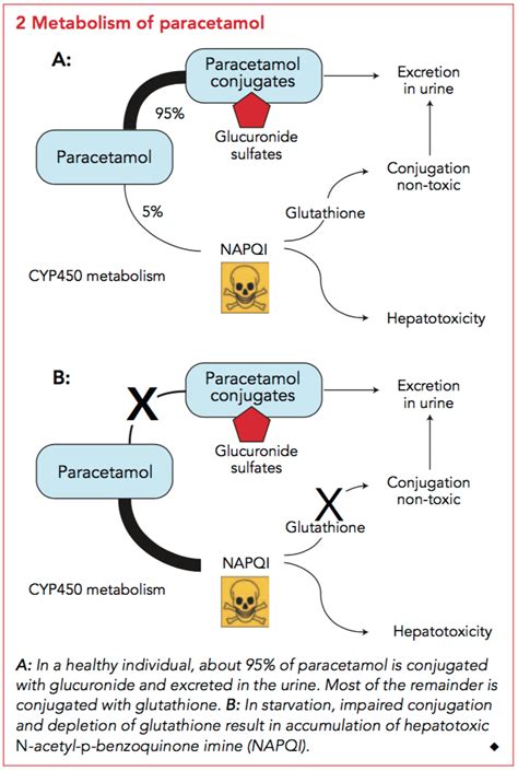 Paracetamol Overdose Stages
