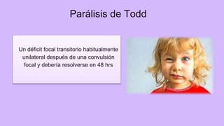 Paralisia De Todd