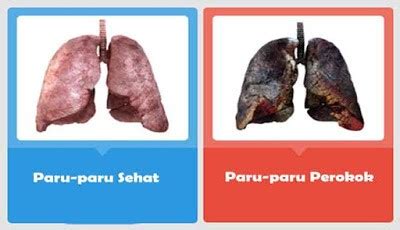 paru paru perokok