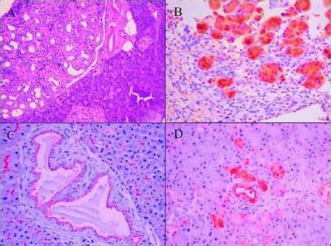 pathomorphology - pathology of cell . parenchymal dystrophy