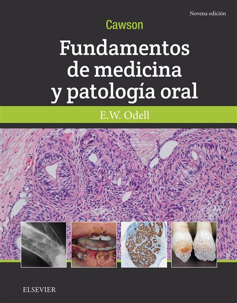 patologia bucal cawson pdf