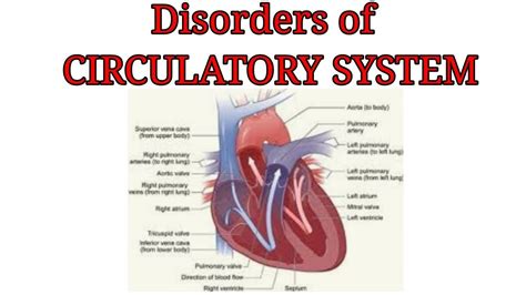 Pdf Chapter 8 Cardiovascular System Diseases And Disorders Heart Disease Worksheet - Heart Disease Worksheet