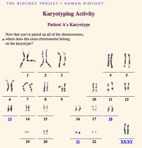 Pdf Karyotyping Lab Grosse Pointe Public Schools Biology Karyotype Worksheet Answers Key - Biology Karyotype Worksheet Answers Key