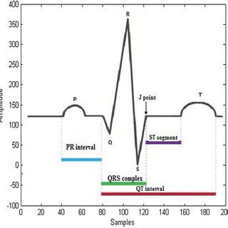 Peak Detection In Ecg Waveform Using Labview