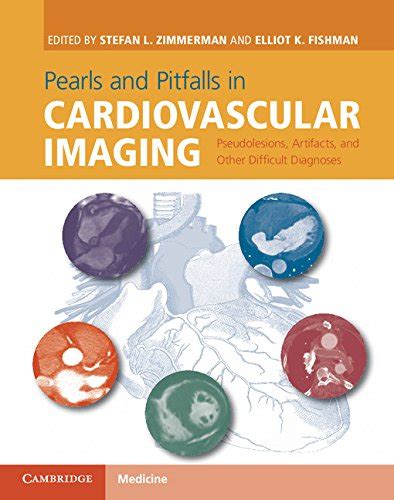 pearls and pitfalls in cardiovascular imaging pseudolesions artifacts and other difficult diagnoses