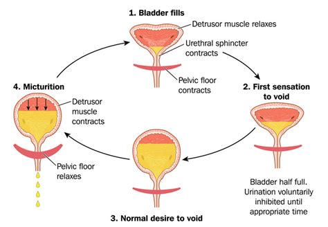 Read Online Pediatric Voiding Dysfunction Current Evaluation And 