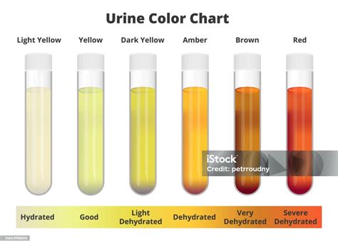 pee colors