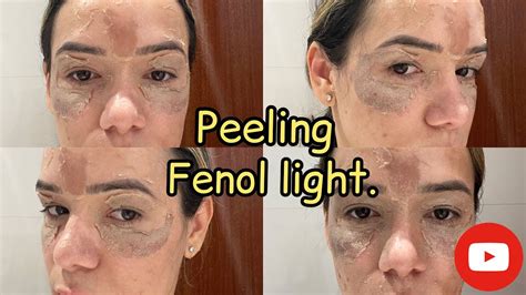 Peeling De Fenol Light