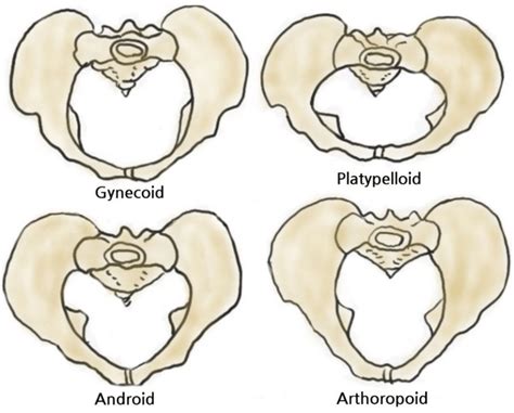 Pelvic Shape Classification