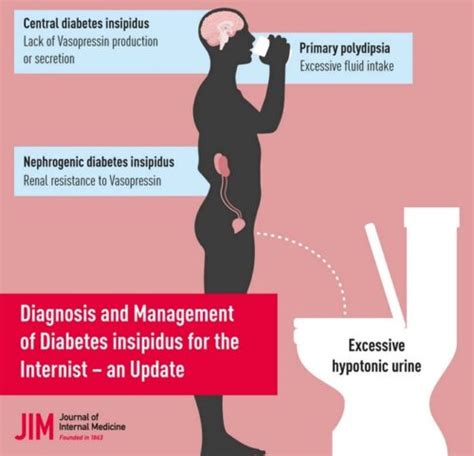 PENGERTIAN DIABETES INSIPIDUS：Diabetes insipidus - Definition, MeaningSynonyms -