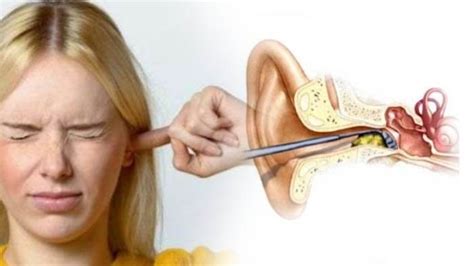 penyebab telinga sakit