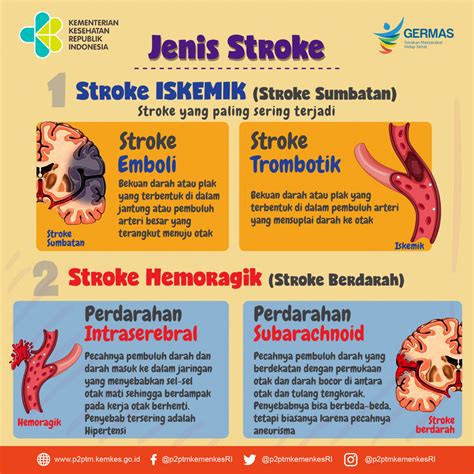 perbedaan stroke hemoragik dan non hemoragik