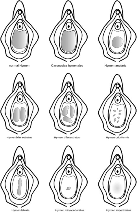 Full Download Perforated Hymen Manual Guide 