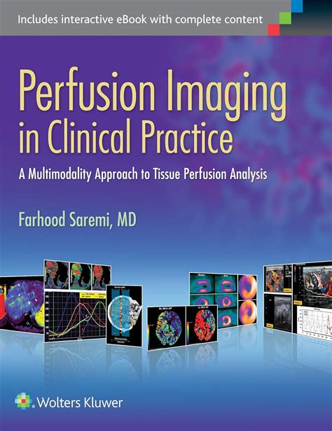 Perfusion Imaging In Clinical Practice A Multimodality Approach To Tissue Perfusion Analysis