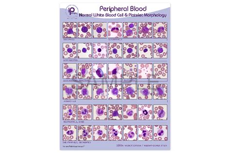 Peripheral Blood Morphology