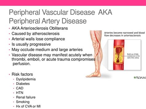 peripheral vascular disease concept map