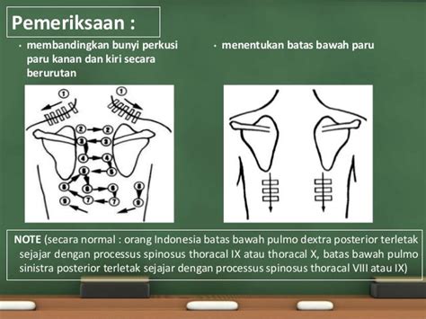 Perkusi Jantung Normal