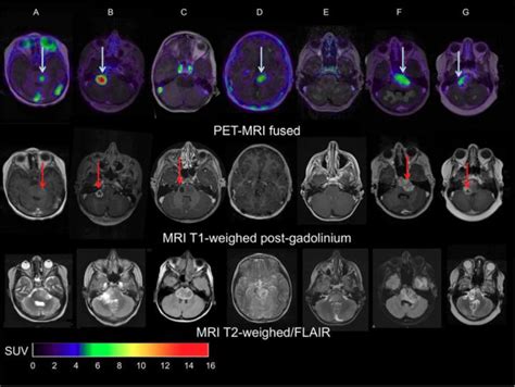 pet mri fusion imaging software