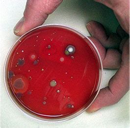 Petri Dish Surprise Andy Jones Live Petri Dish Science Experiment - Petri Dish Science Experiment