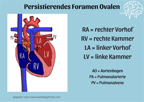 Pfo Icd 10