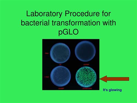 Pglo Transformation Lab Answer Key