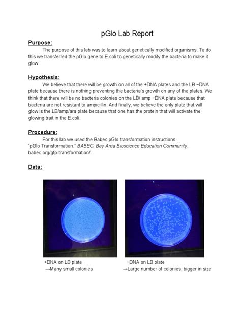 Pglo Transformation Lab Report