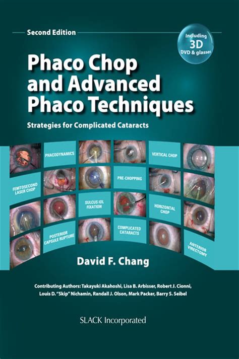 Phaco Chop David Chang