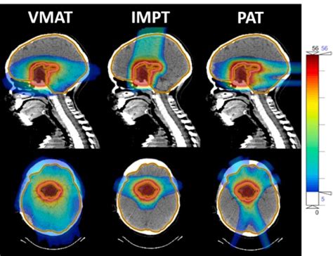 phiRO Physics and Imaging in Radiation Oncology