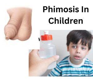 Phimosis Pictures