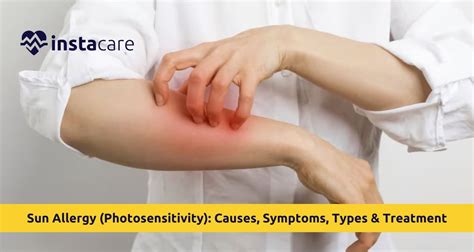 Read Online Photosensitivity 