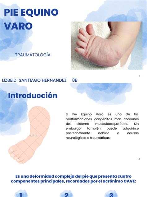 Pie Equino Vari