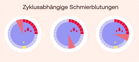 pille abgesetzt lange schmierblutung