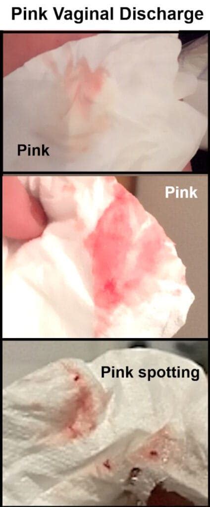 pink colored discharge