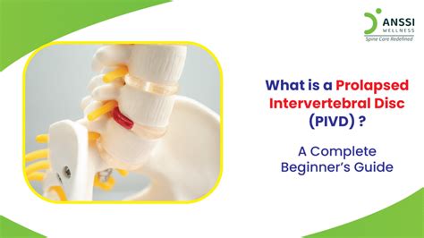 Pivd Icd 10