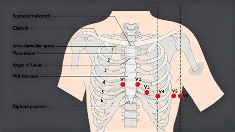 Placing Leads For 12 Lead Ecg
