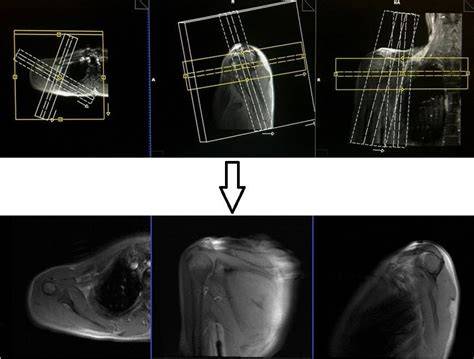 planning and positioning in mri