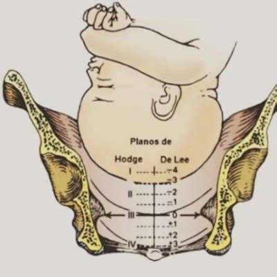 Plano De Lee
