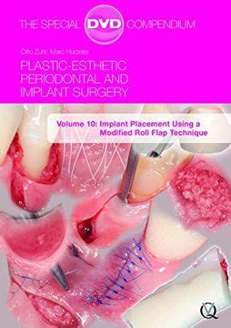 Read Plastic Esthetic Periodontal And Implant Surgery Volume 10 