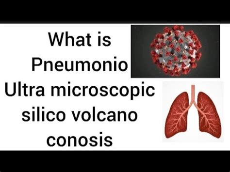 pneumonoultramicroscopicsilico
