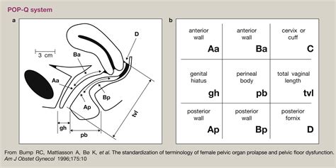 Pop Q Classification
